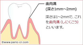 健康な歯