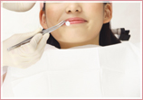 歯のクリーニング･研磨